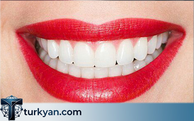 ## Dental Crowns Turkey Package: A Complete Guide for International Patients