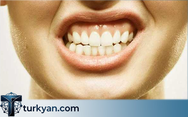 Dental Implant Packages Turkey with Hotel