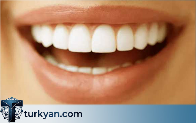 Dental Tourism Turkey Risks