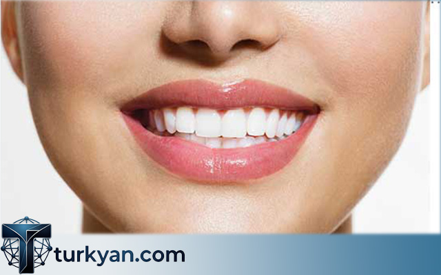 medical tourism turkey dental implants