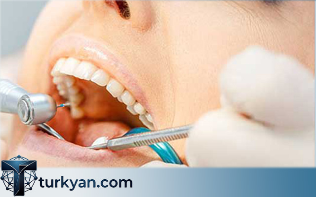 Dental Implants Turkey