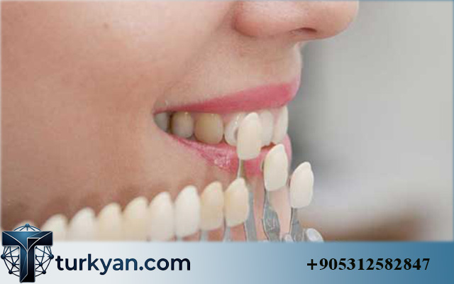 same day dental implants turkey