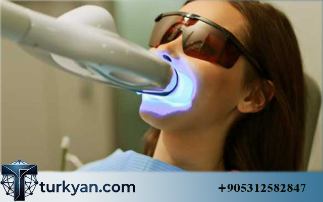 all on 4 dental implants turkey